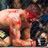 All about MMA