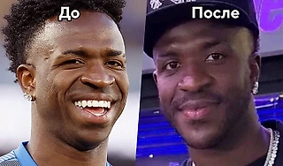 Винисиус изменил себе подбородок – шутят, что теперь похож на своего же двойника. И говорить пока трудно