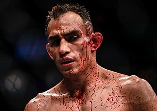 Тони Фергюсон – главный по кровавым боям в UFC. Завтра он возвращается в октагон