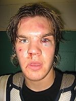 Nekito3, Nekito3