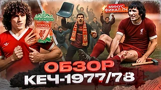 Молоток бьет по ноге, тупые фанаты и сиамские близнецы