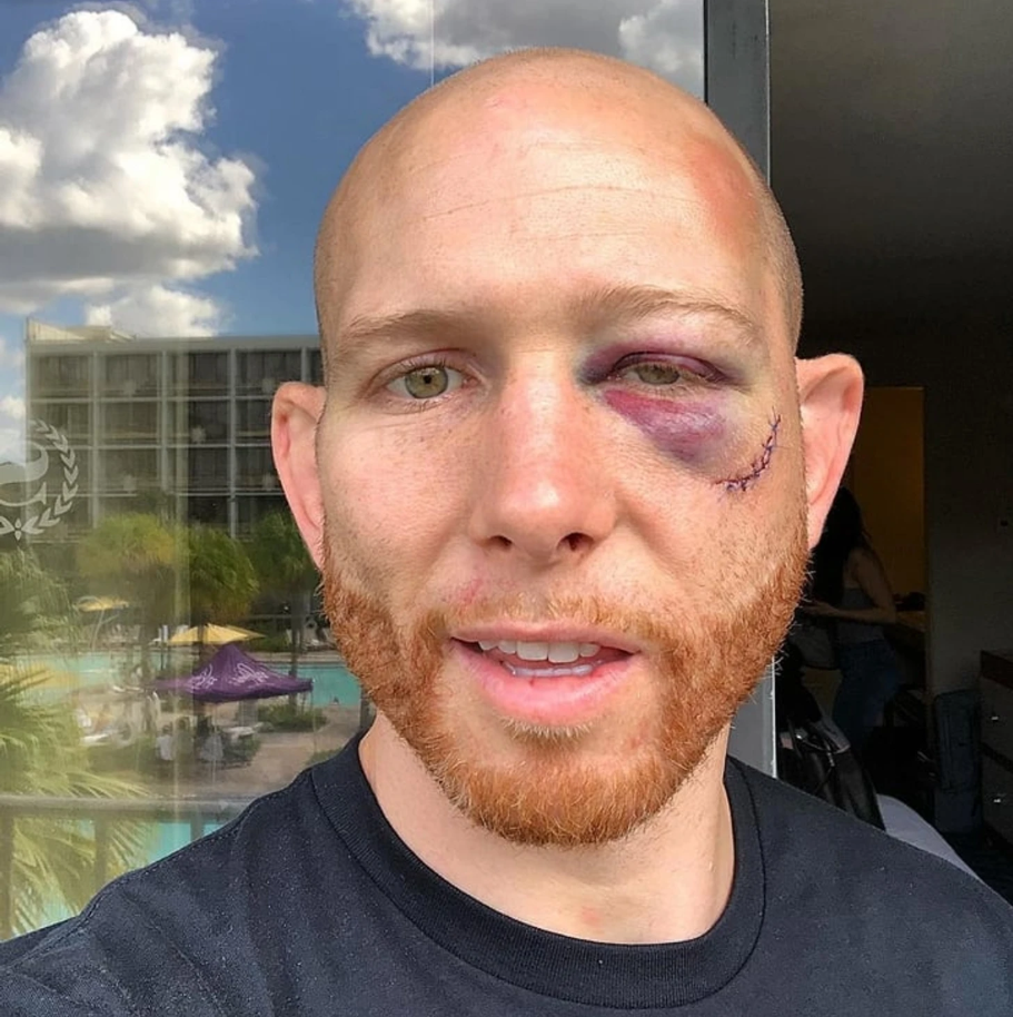 Джош Эмметт, UFC, UFC Fight Night