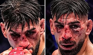 Один из самых больших апсетов в истории UFC – Гейджи разбил Топурию. Лицо Илии – кошмар 😯